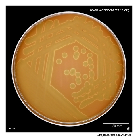Streptococcus pneumoniae ATCC 49619 on blood agar after 48 hours in 5% CO2