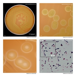 Composite laboratory image panel of Streptococcus pneumoniae with preview photographs from the species overview page
