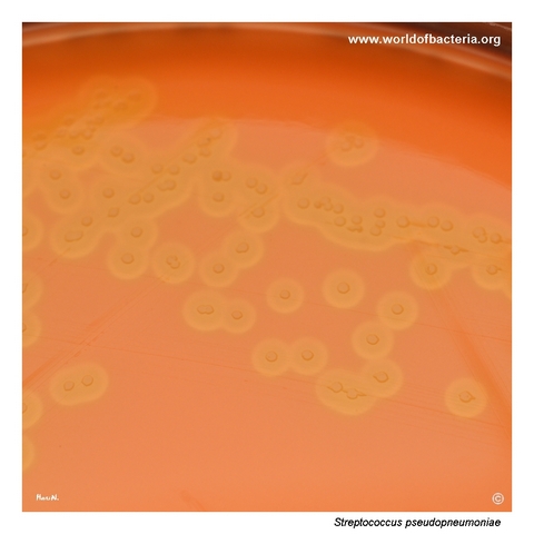 Alpha-haemolytic colonies of Streptococcus pseudopneumoniae on blood agar