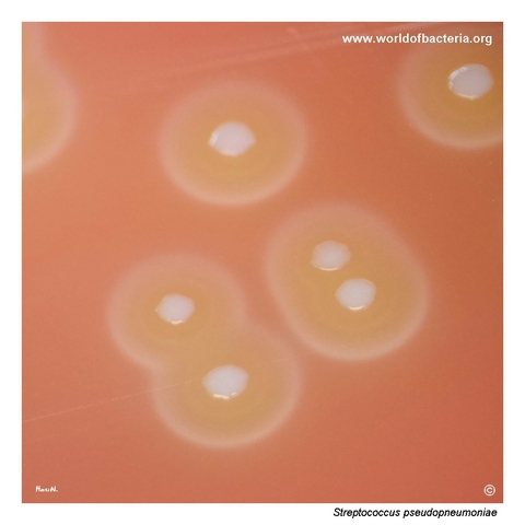 Flattened alpha-haemolytic colonies of Streptococcus pseudopneumoniae on blood agar