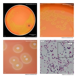 Composite laboratory image panel of Streptococcus pseudopneumoniae with preview photographs from the species overview page