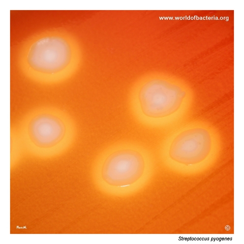 Large beta-haemolytic emm3 colonies of Streptococcus pyogenes on blood agar