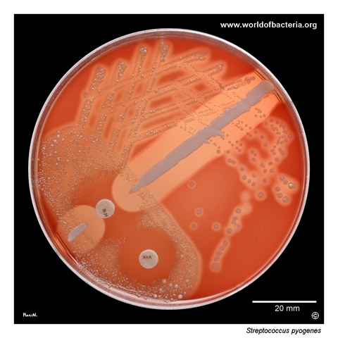 Classic beta-haemolytic colonies of Streptococcus pyogenes on blood agar