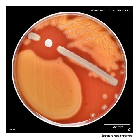 Near-pure growth of Streptococcus pyogenes from a vaginal swab on blood agar