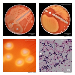 Composite laboratory image panel of Streptococcus pyogenes with preview photographs from the species overview page