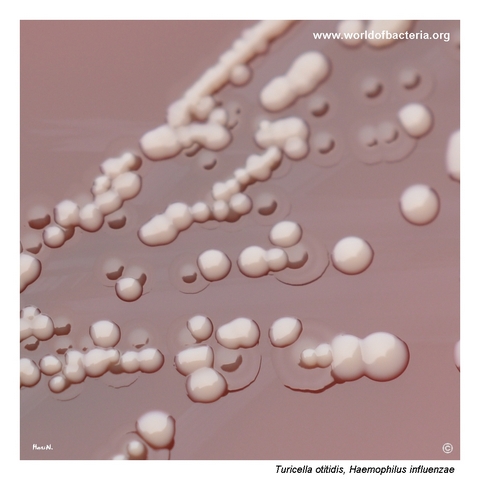 Colonies of Turicella otitidis and Haemophilus influenzae on blood agar