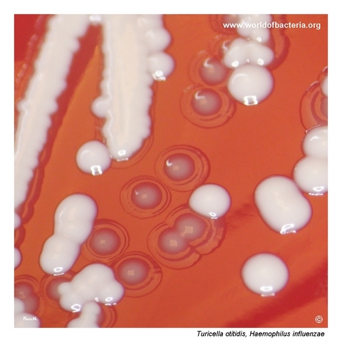 Close-up view of Turicella otitidis colonies in mixed culture with Haemophilus influenzae