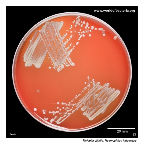 Mixed culture of Turicella otitidis and Haemophilus influenzae from paracentesis material
