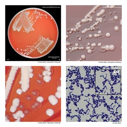 Composite laboratory image panel of Turicella otitidis with preview photographs from the species overview page
