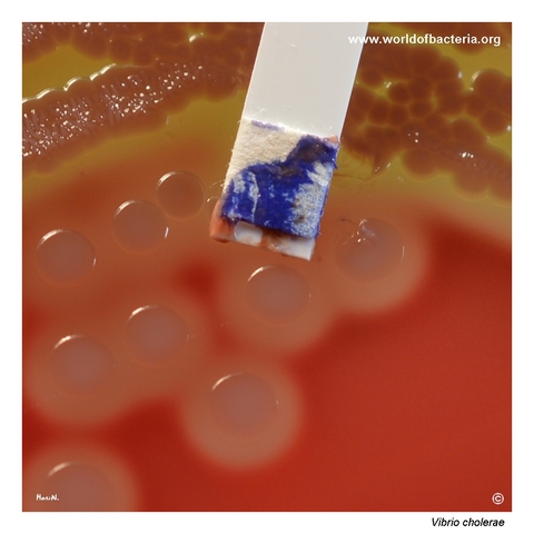 Positive oxidase test with rapid blue coloration for Vibrio cholerae