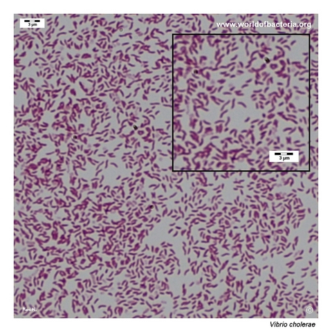 Gram-negative curved and comma-shaped Vibrio cholerae rods