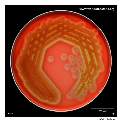 Haemolytic non-O1 Vibrio cholerae culture on sheep blood agar