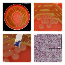 Composite laboratory image panel of Vibrio cholerae with preview photographs from the species overview page