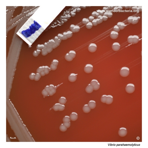 Slightly yellowish Vibrio parahaemolyticus colonies on blood agar