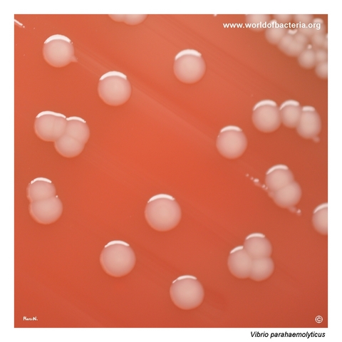 Close-up of smooth convex non-haemolytic Vibrio parahaemolyticus colonies