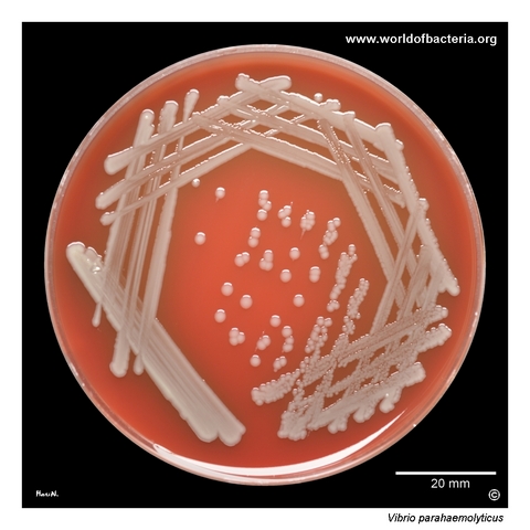 Vibrio parahaemolyticus culture without visible haemolysis on sheep blood agar
