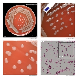 Composite laboratory image panel of Vibrio parahaemolyticus with preview photographs from the species overview page