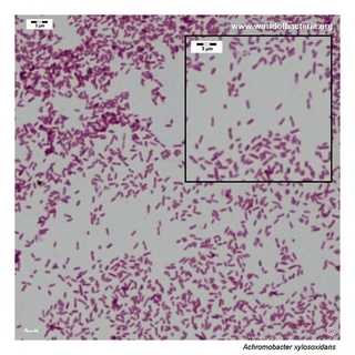 Gram stain microscopy of Achromobacter xylosoxidans showing gram-negative rods