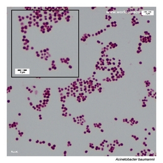 Gram stain microscopy of Acinetobacter baumannii showing gram-negative coccobacilli