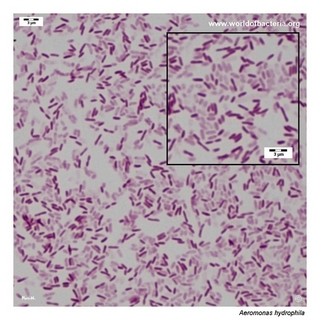 Gram stain microscopy of Aeromonas hydrophila showing gram-negative rods