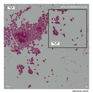 Gram stain microscopy of Aeromonas veronii showing gram-negative rods