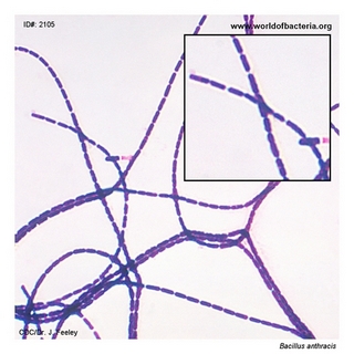 Gram stain microscopy of Bacillus anthracis showing gram-positive rods