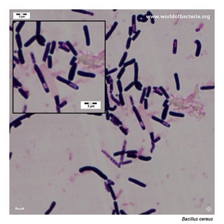 Gram stain microscopy of Bacillus cereus showing gram-positive rods