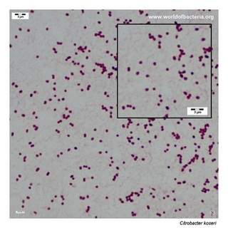 Gram stain microscopy of Citrobacter koseri showing gram-negative rods