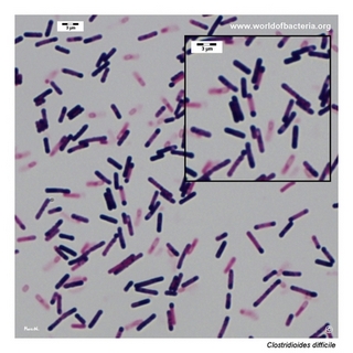Gram stain microscopy of Clostridioides difficile showing gram-positive rods