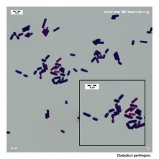 Gram stain microscopy of Clostridium perfringens showing gram-positive rods
