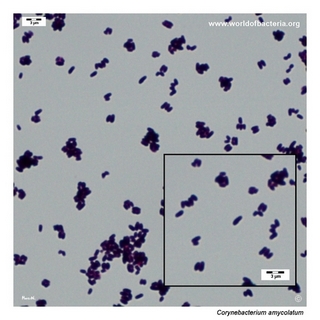 Gram stain microscopy of Corynebacterium amycolatum showing gram-positive rods