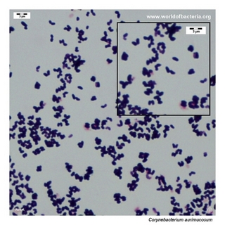 Gram stain microscopy of Corynebacterium aurimucosum showing gram-positive pleomorphic coryneform rods