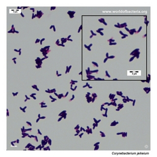 Gram stain microscopy of Corynebacterium jeikeium showing gram-positive pleomorphic coryneform rods