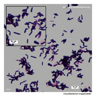 Gram stain microscopy of Corynebacterium kroppenstedtii showing gram-positive pleomorphic coryneform rods