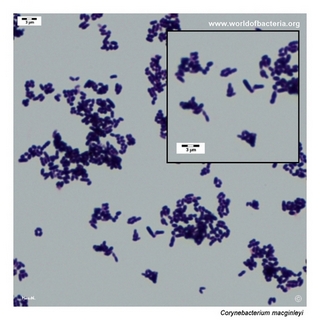 Gram stain microscopy of Corynebacterium macginleyi showing gram-positive pleomorphic coryneform rods
