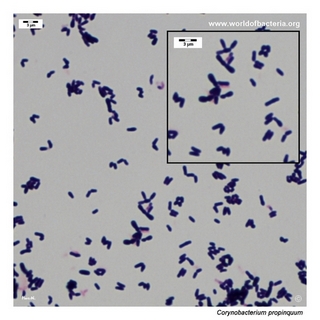 Gram stain microscopy of Corynebacterium propinquum showing gram-positive pleomorphic coryneform rods