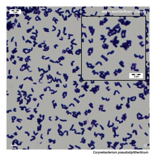 Gram stain microscopy of Corynebacterium pseudodiphtheriticum showing gram-positive pleomorphic coryneform rods
