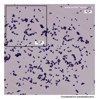 Gram stain microscopy of Corynebacterium pseudotuberculosis showing gram-positive pleomorphic coryneform rods