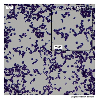 Gram stain microscopy of Corynebacterium striatum showing gram-positive pleomorphic coryneform rods
