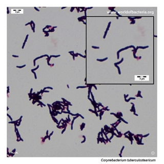 Gram stain microscopy of Corynebacterium tuberculostearicum showing gram-positive pleomorphic coryneform rods