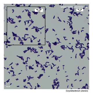 Gram stain microscopy of Corynebacterium ulcerans showing gram-positive pleomorphic coryneform rods