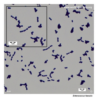 Gram stain microscopy of Enterococcus faecalis showing gram-positive cocci in pairs and short chains