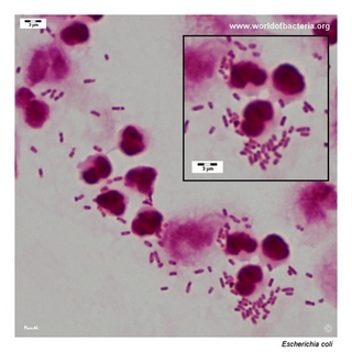 Gram stain microscopy of Escherichia coli (Beta-haemolytic strain) showing gram-negative rods