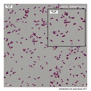 Gram stain microscopy of Escherichia coli (Nissle 1917 strain) showing gram-negative rods