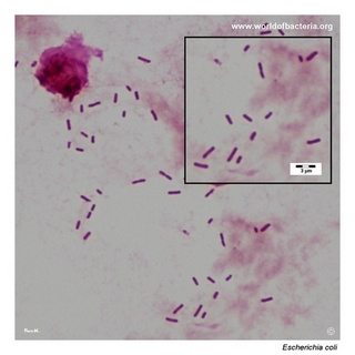 Gram stain microscopy of Escherichia coli (Non-haemolytic strain) showing gram-negative rods