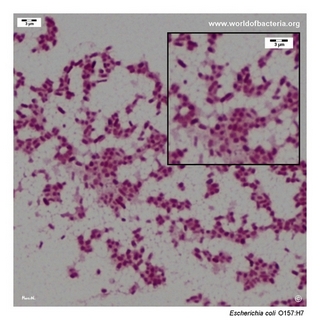 Gram stain microscopy of Escherichia coli (STEC strain, O157:H7) showing gram-negative rods