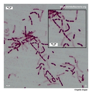 Gram stain microscopy of Kingella kingae showing gram-negative coccobacilli