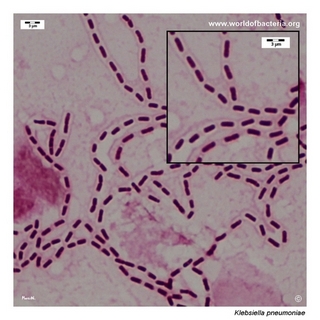 Gram stain microscopy of Klebsiella pneumoniae showing gram-negative rods