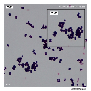 Gram stain microscopy of Kocuria rhizophila showing gram-positive cocci in tetrads