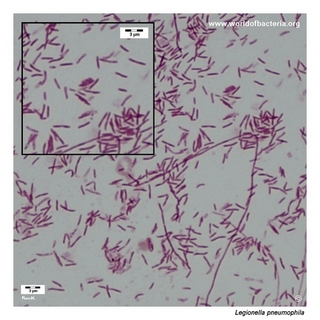Gram stain microscopy of Legionella pneumophila showing gram-negative rods